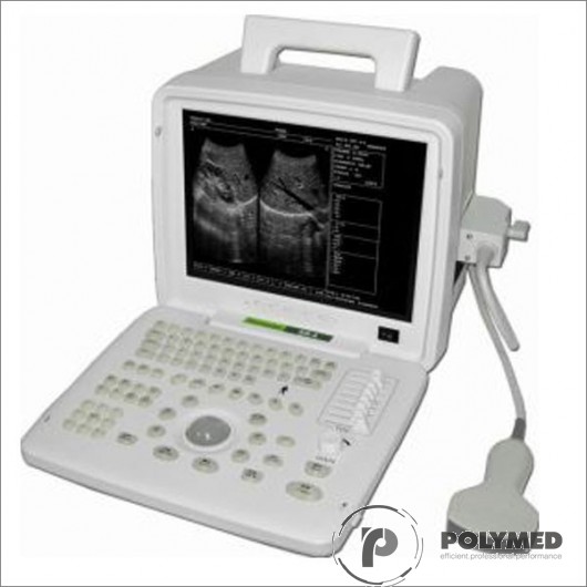 Ecograf portabil full digital SS4 - Polymed