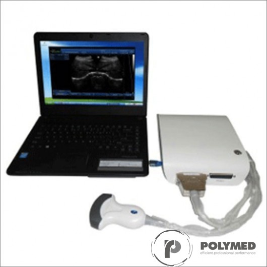 Ecograf portabil alb/negru UBox 10 - Polymed