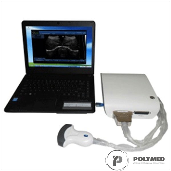Ecograf portabil alb/negru UBox 10 - Polymed